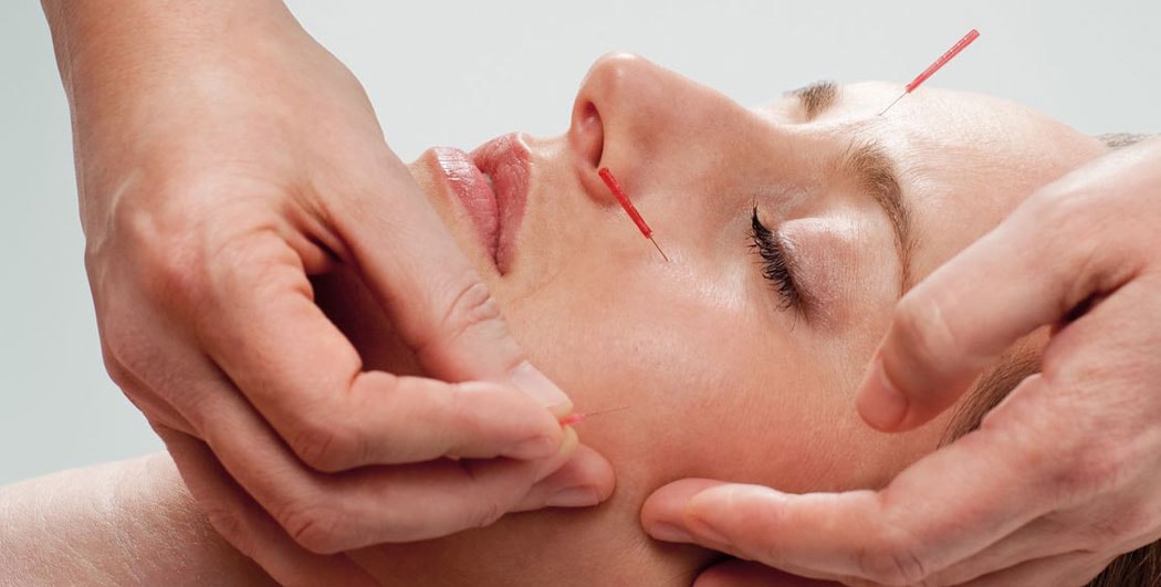 Acupuncture needles treatment